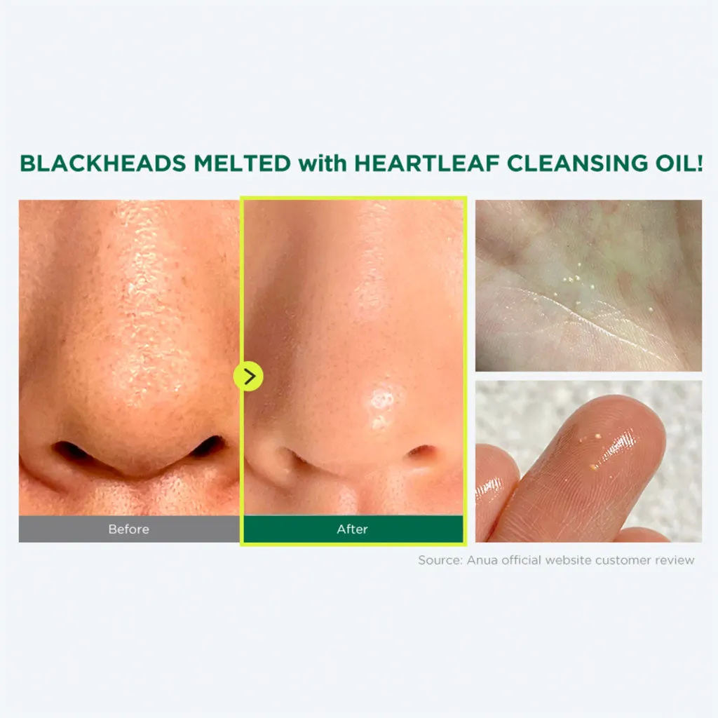 Heartleaf Pore Control Cleansing Oil